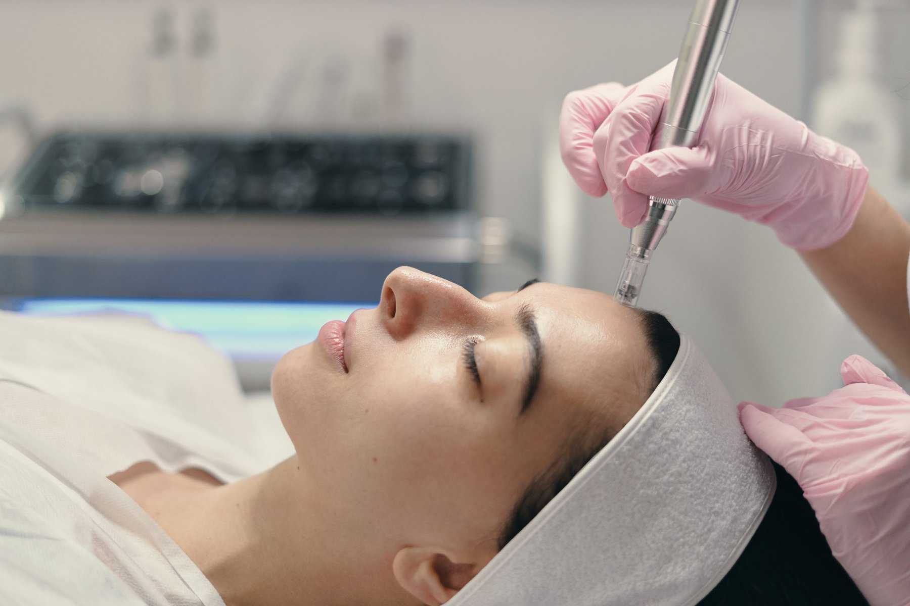 Microneedling — Rostro + Cuello - Estimula colágeno y mejora textura en rostro y cuello.