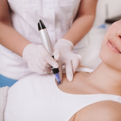 Microneedling — Estrías (según área) - Atenúa estrías y mejora apariencia según zona tratada.
